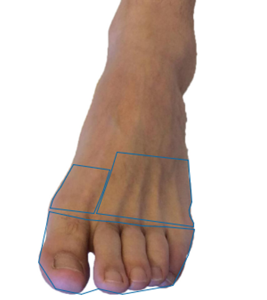 Top of foot